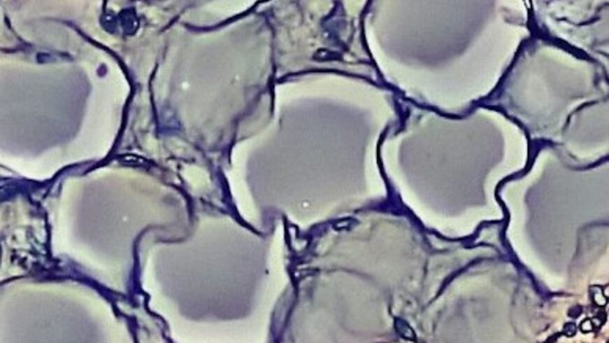 adipocytes